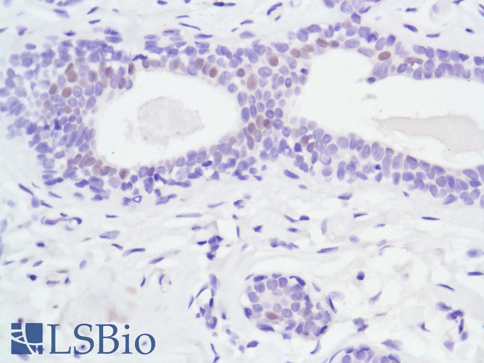 Monoclonal Rabbit anti-Human AR / Androgen Receptor Antibody (clone SP107, N-Terminus, IHC)