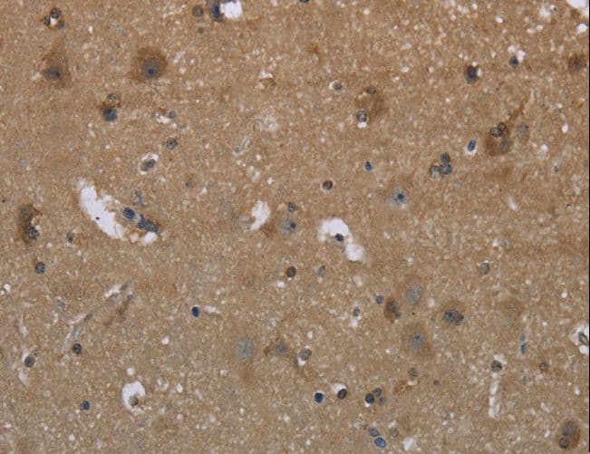 Polyclonal Rabbit anti-Human GYS2 Antibody (IHC)