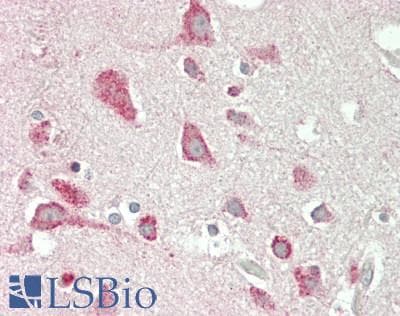 IHC-plus™ C1QL3 Antibody (Internal)