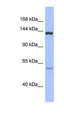 DHX34 Antibody (C-Terminus)