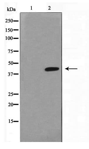 Polyclonal Rabbit anti-Human HTR1A / 5-HT1A Receptor Antibody (WB)