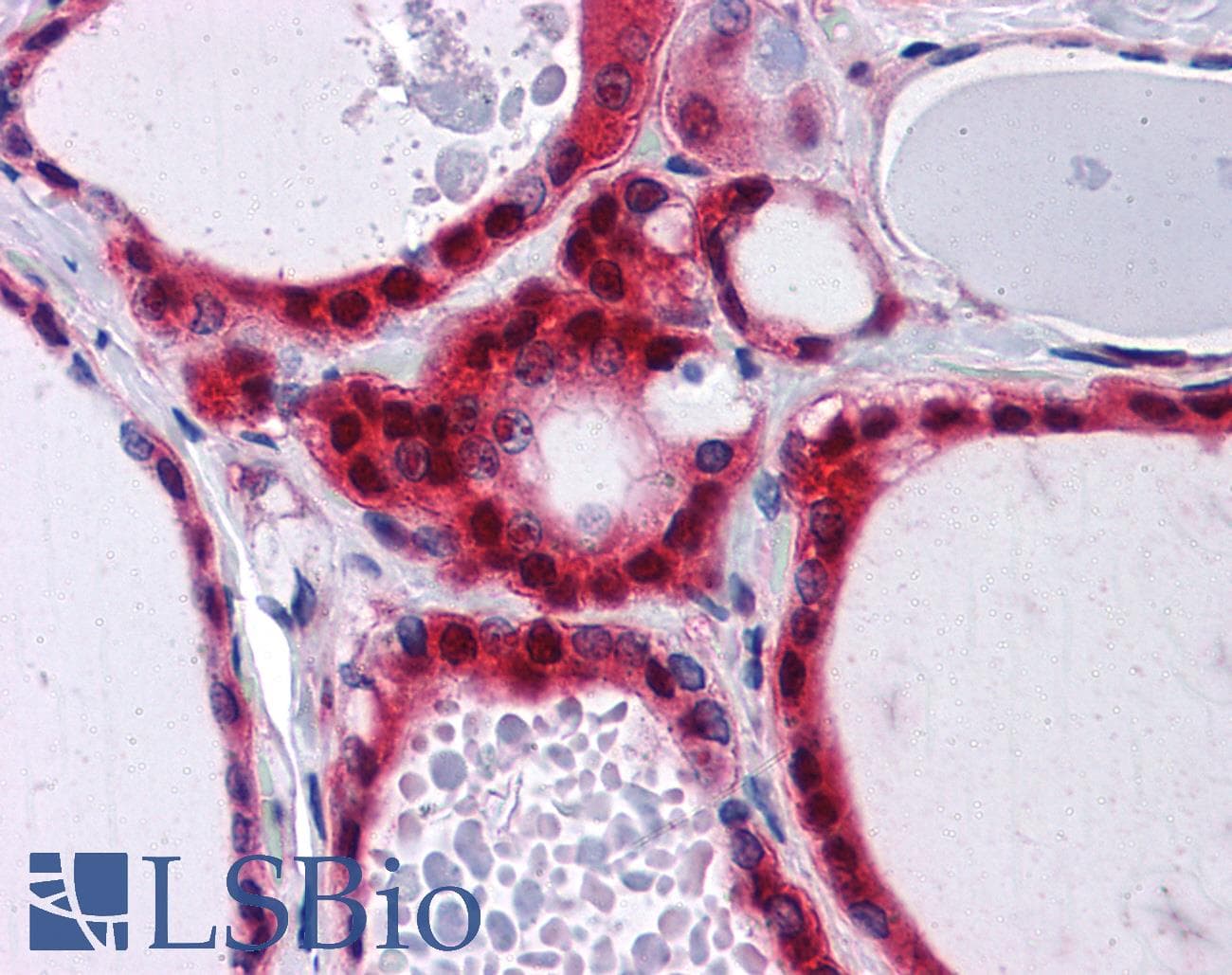 IHC-plus™ HNRNP-E2 / PCBP2 Antibody (clone 5F12)