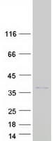 Human SKA1 Protein (Recombinant Myc-DDK (Flag))