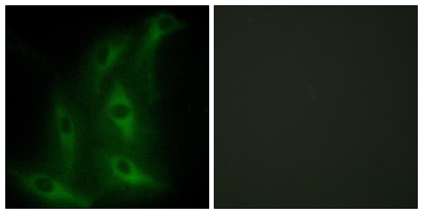 COL4A6 / Collagen IV Antibody