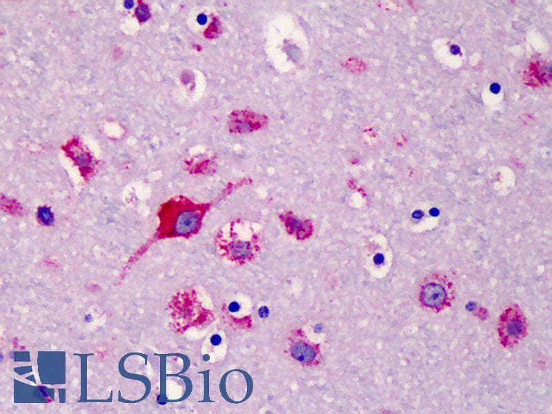IHC-plus™ SLC35D1 Antibody