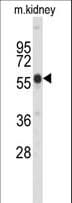 Polyclonal Rabbit anti-Human PINK1 Antibody (aa493-526, WB)