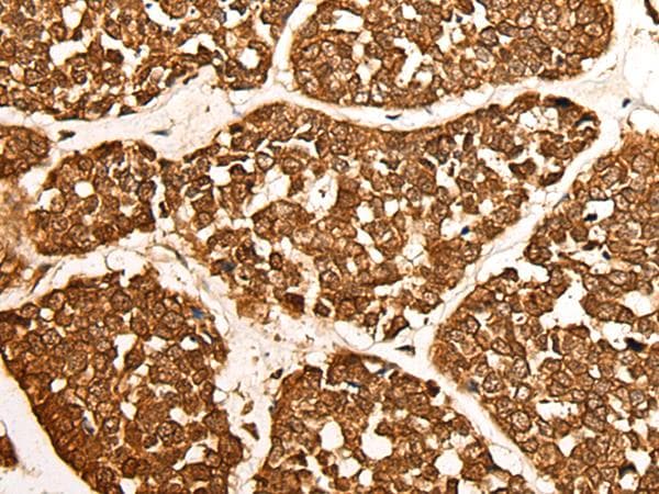 CALML6 Antibody