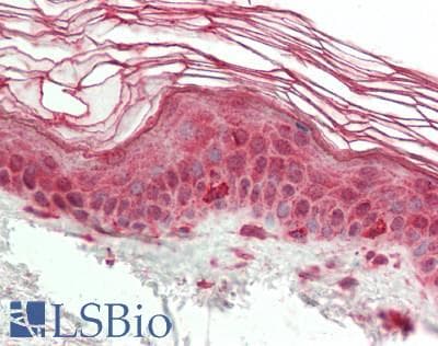 Hairless / HR Antibody (aa697-746)