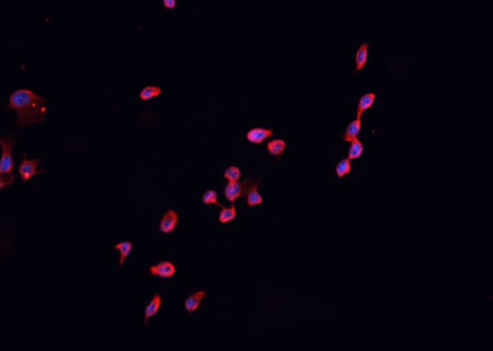 CDKN2B / p15 INK4b Antibody