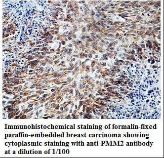 Polyclonal Rabbit anti-Human PMM2 Antibody (aa40-234, IHC, WB)