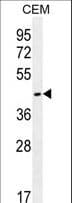 OR8H2 Antibody (aa244-272)