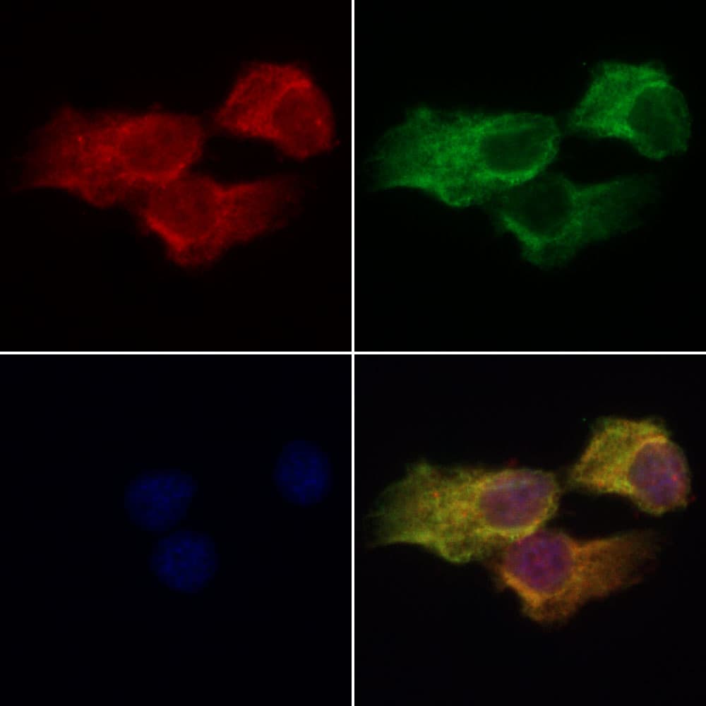 Polyclonal Rabbit anti-Human CBFA2T3 Antibody (IF, WB)