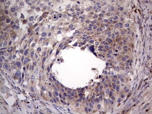 Monoclonal Mouse anti-Human PKM2 Antibody (clone 1F12, IHC, WB)
