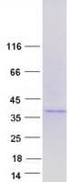 Human METTL9 / PAP1 Protein (Recombinant Myc-DDK (Flag))