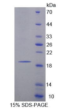 Rat MARCO Protein (Recombinant His-T7)