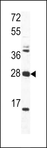 Polyclonal Rabbit anti-Human OAZ1 / OAZ Antibody (aa2-31, IHC, WB)