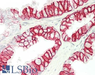 IHC-plus™ SLC16A1 / MCT1 Antibody