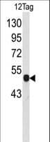 Polyclonal Rabbit VSV-g Tag Antibody (WB)