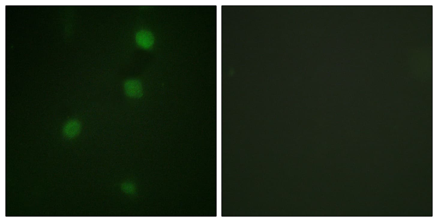 Polyclonal Rabbit anti-Human RB1 / Retinoblastoma / RB Antibody (aa791-840, IHC, IF)