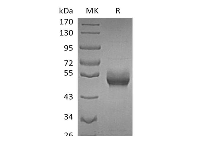 Human B4GALT1 Protein (Recombinant 6His, C-terminus)