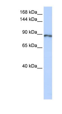 CAPN15 / SOLH Antibody (aa1008-1057)