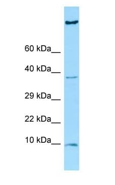 HGSNAT Antibody (aa563-612)