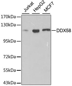 Polyclonal Rabbit anti-Human DDX58 / RIG-1 / RIG-I Antibody (IHC, IF, WB)