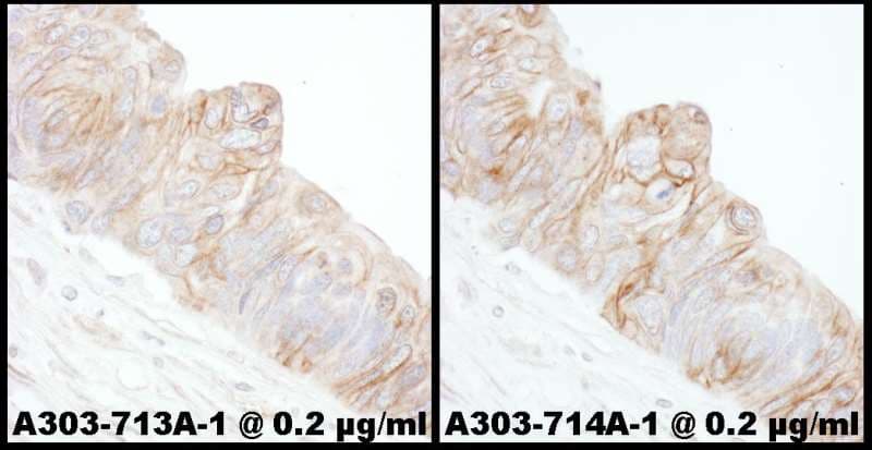 ADD1 / Adducin Alpha Antibody (aa550-600)