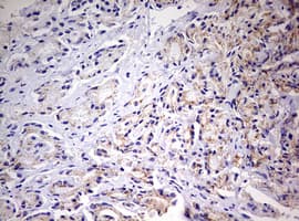 PRX-1 / PRRX1 Antibody (clone OTI2B2)