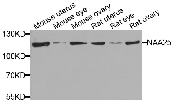 Polyclonal Rabbit anti-Human NAA25 Antibody (WB)