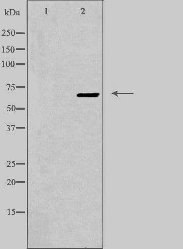 Polyclonal Rabbit anti-Human EPN3 Antibody (IHC, IF, WB)