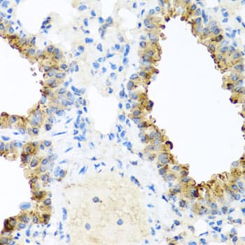 NIN / Ninein Antibody