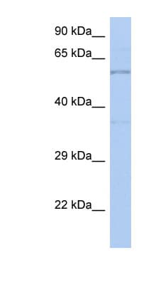 TH / Tyrosine Hydroxylase Antibody (aa35-84)
