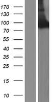 Neurochondrin Protein (Over-Expression Lysate Myc-DDK (Flag))