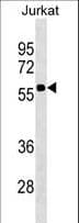 CD1A Antibody (aa76-104)
