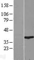 RNF2 / RING2 / RING1B Protein (Over-Expression Lysate Myc-DDK (Flag))