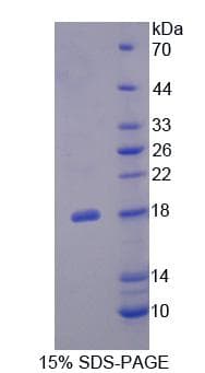 Human FLRT3 Protein (Recombinant His-T7)