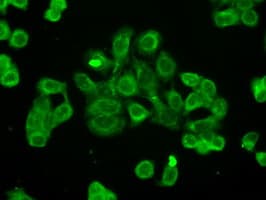 Monoclonal Mouse anti-Human CYPOR / POR Antibody (clone OTI1B11, IHC, IF, WB)