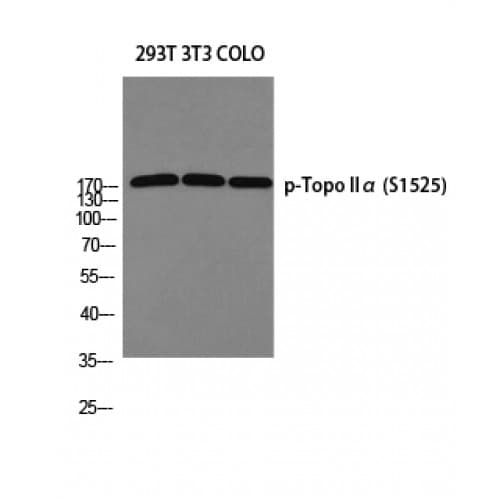 TOP2A / Topoisomerase II Alpha Antibody (1450-1530 aa)