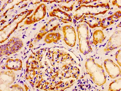 Polyclonal Rabbit anti-Human HSPE1 / HSP10 / Chaperonin 10 Antibody (IHC, WB)