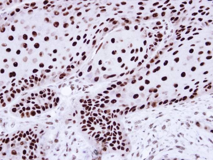 HNRNPC / HNRNP C Antibody (aa1-142)