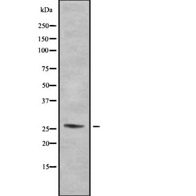 SH3BGR Antibody