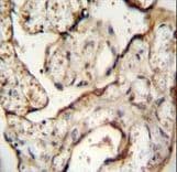 EGFR Antibody (aa1004-1033)