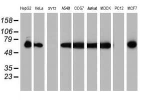 PDIA4 / ERP72 Antibody (clone OTI6B6)