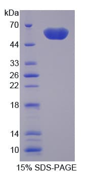 Mouse TREM2 / TREM-2 Protein (Recombinant His-GST)