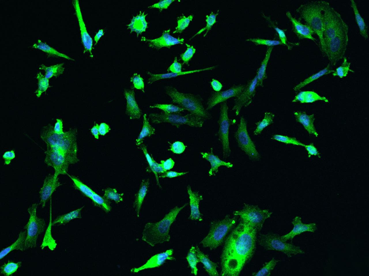 Polyclonal Rabbit anti-Human DENR / Density Regulated Antibody (IHC, IF, WB)