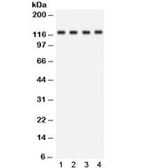 SLC12A1 / NKCC2 Antibody