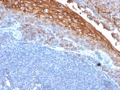 MCAM / CD146 Antibody (clone rMUC18/1130)