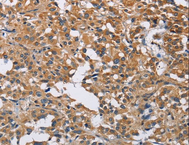 DNMT3A Antibody