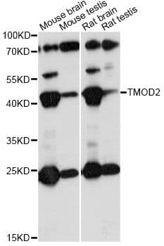 Polyclonal Rabbit anti-Human TMOD2 / Tropomodulin 2 Antibody (WB)